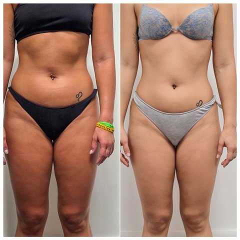 Prima e dopo