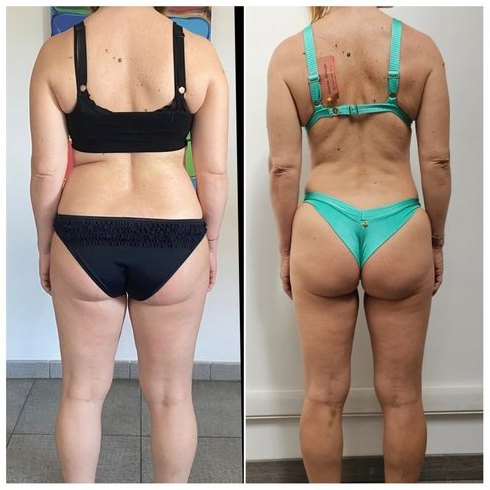 Prima e dopo